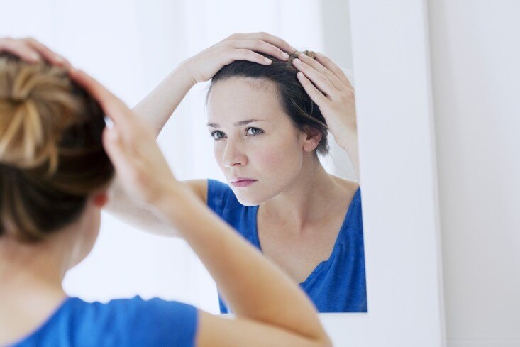 menopause-hair-loss